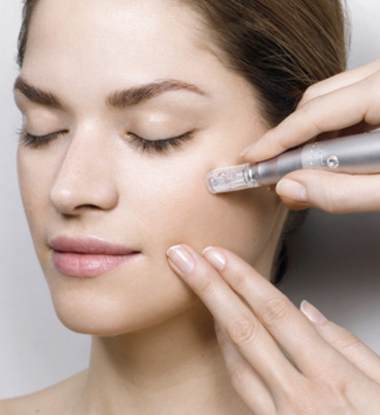 Microneedling